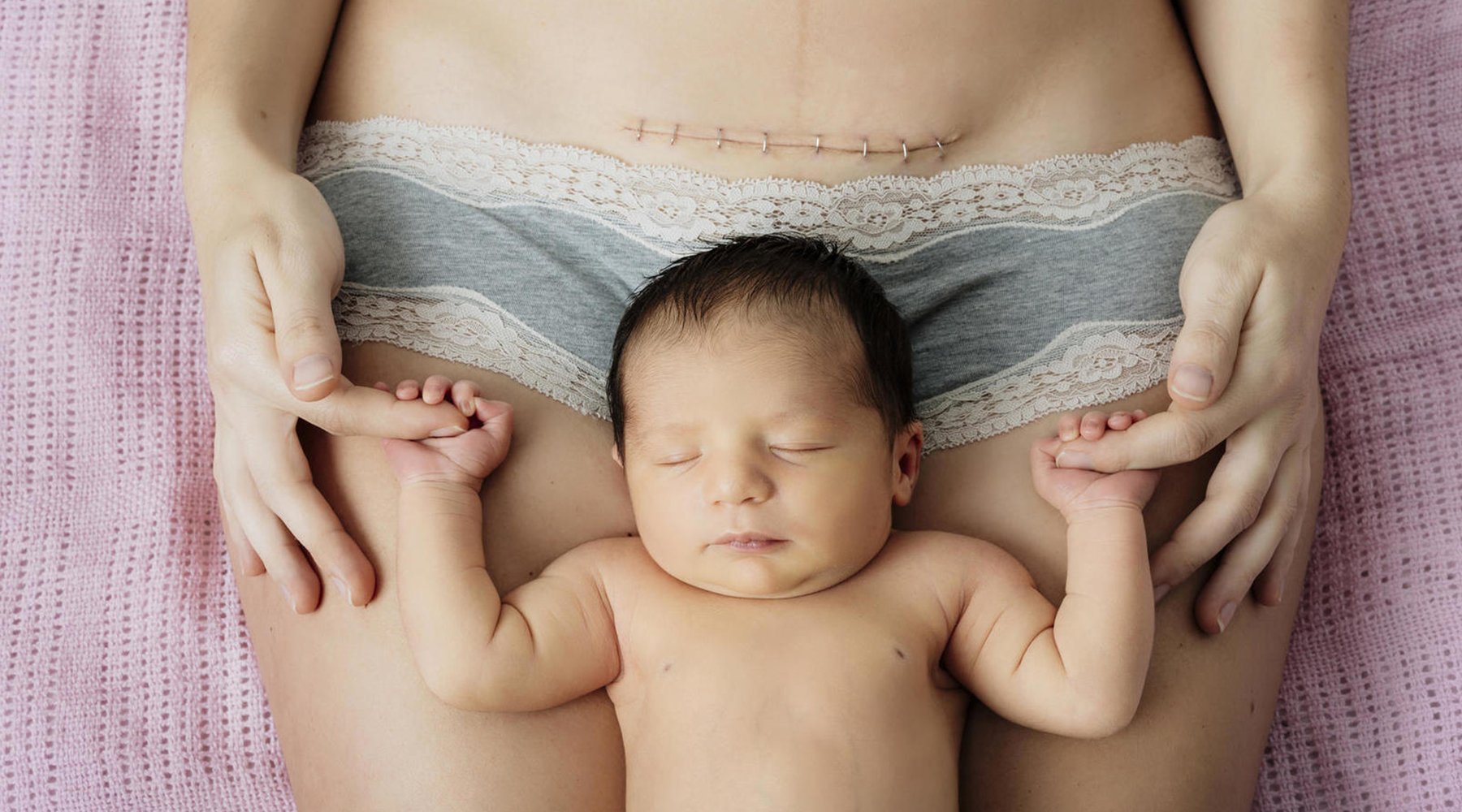 9 Myths about C-Section that Need to Be Busted! - Lovemère